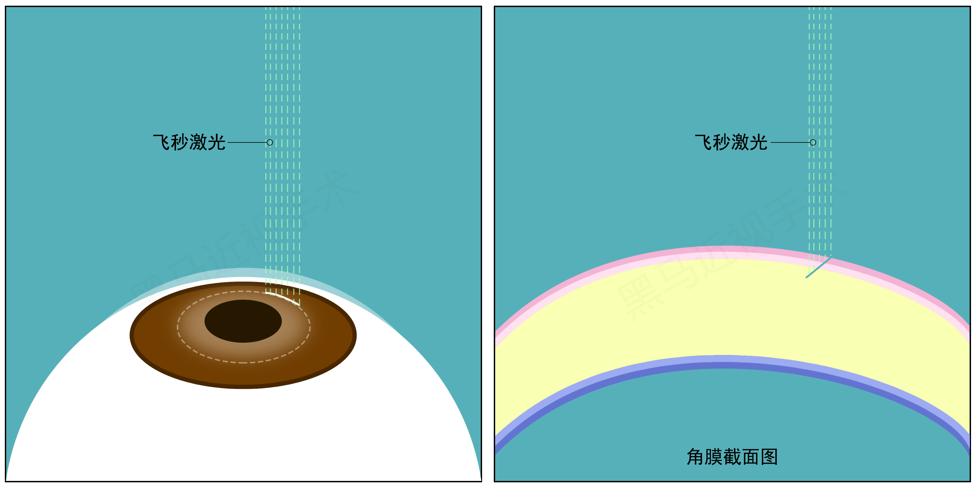 全飞秒步骤三 全飞秒步骤三